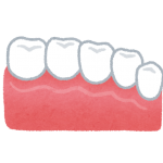 銀歯を白い歯に変える治療方法
